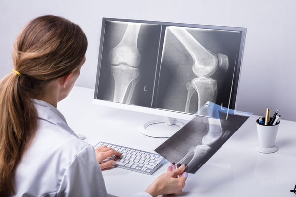 Doctor looking at X-ray