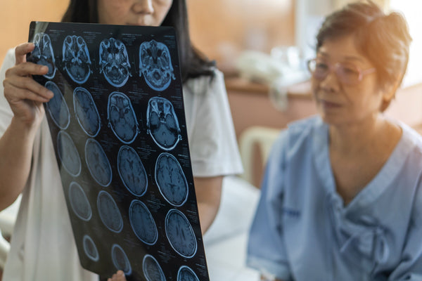 Early Menopause and Stroke Risk: What Every Woman Needs to Know