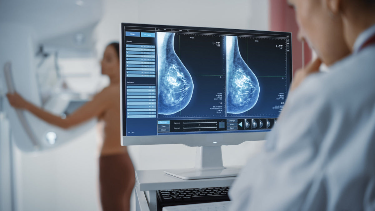 Do You Still Need Mammograms After Menopause?